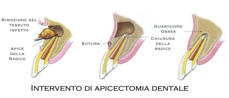 Igiene Professionale